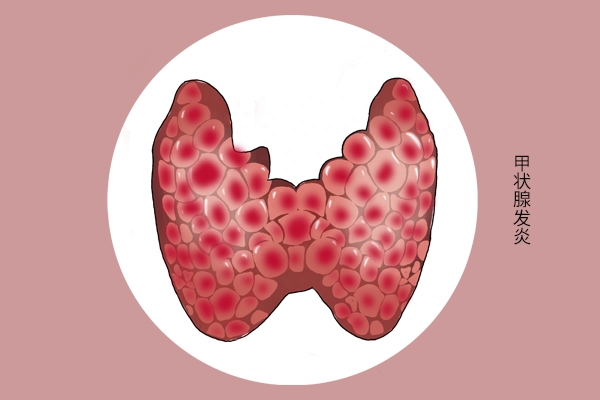 补硒要补什么样的硒