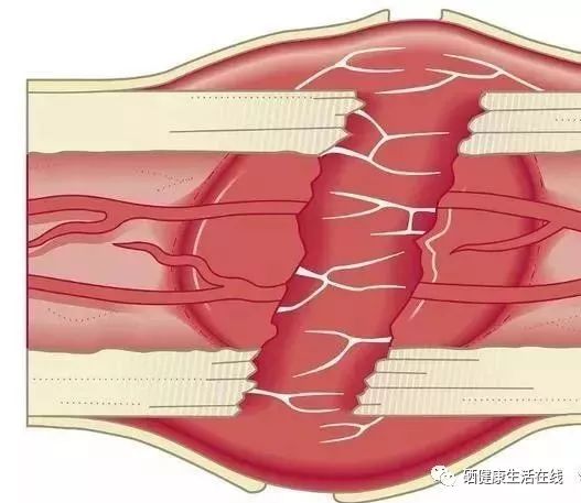 补硒后身体有调节反应