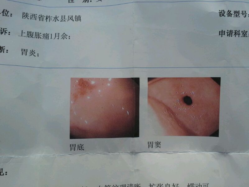 慢性胃炎可以补硒吗吗