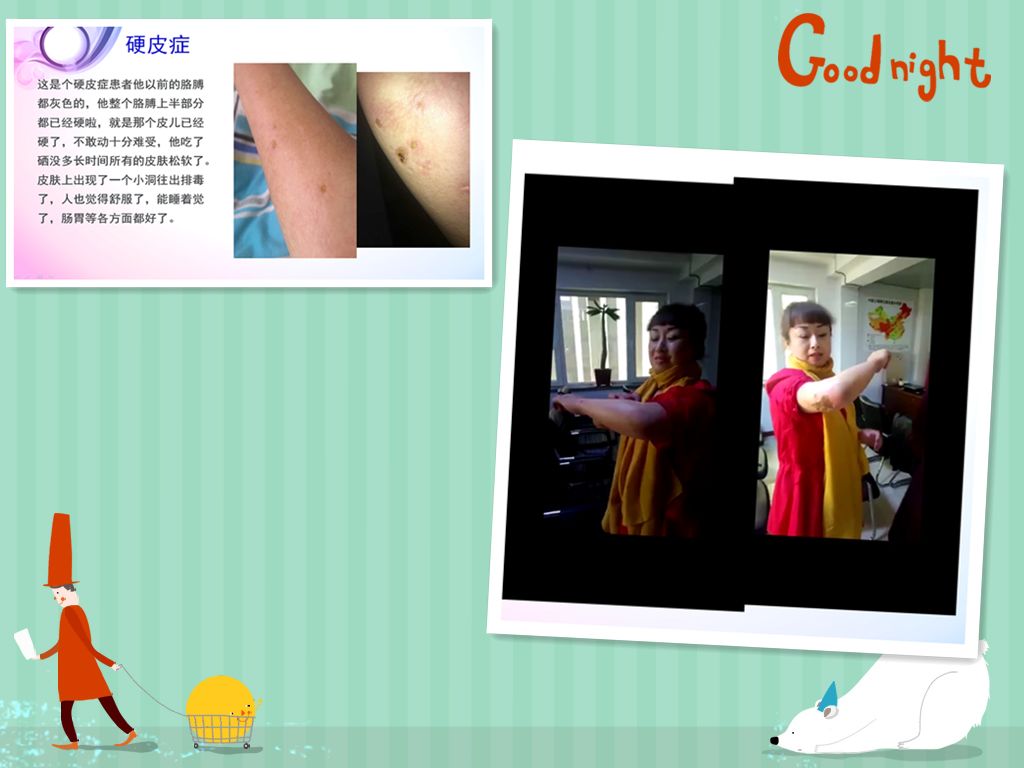肝病患者补硒治愈视频