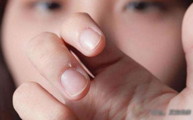 忠告家长：孩子这6个小毛病，其实是严重缺锌了！宝妈别大意