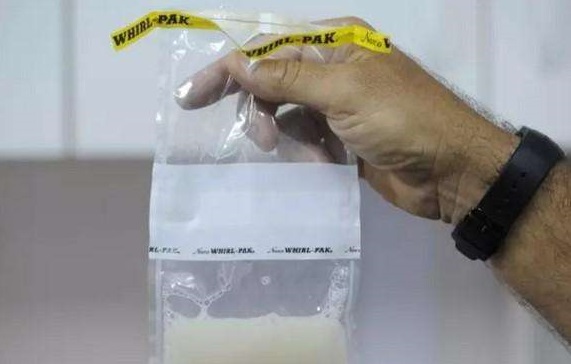 补硒 有助精子质量吗