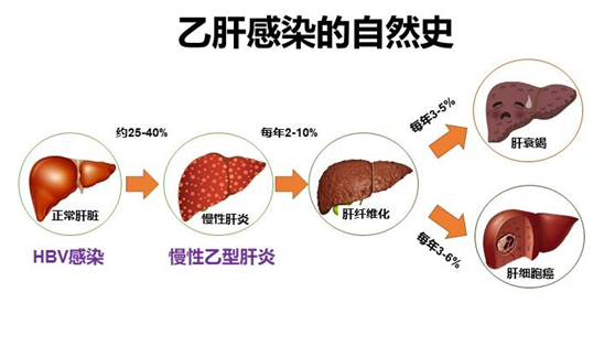 肝癌患者补麦芽硒好吗