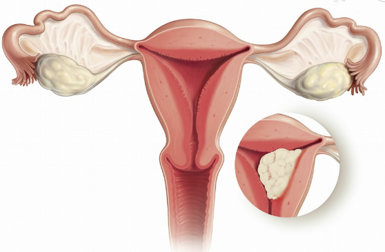 hpv补硒有什么好处