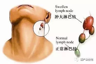 甲状腺肿块可以补硒吗