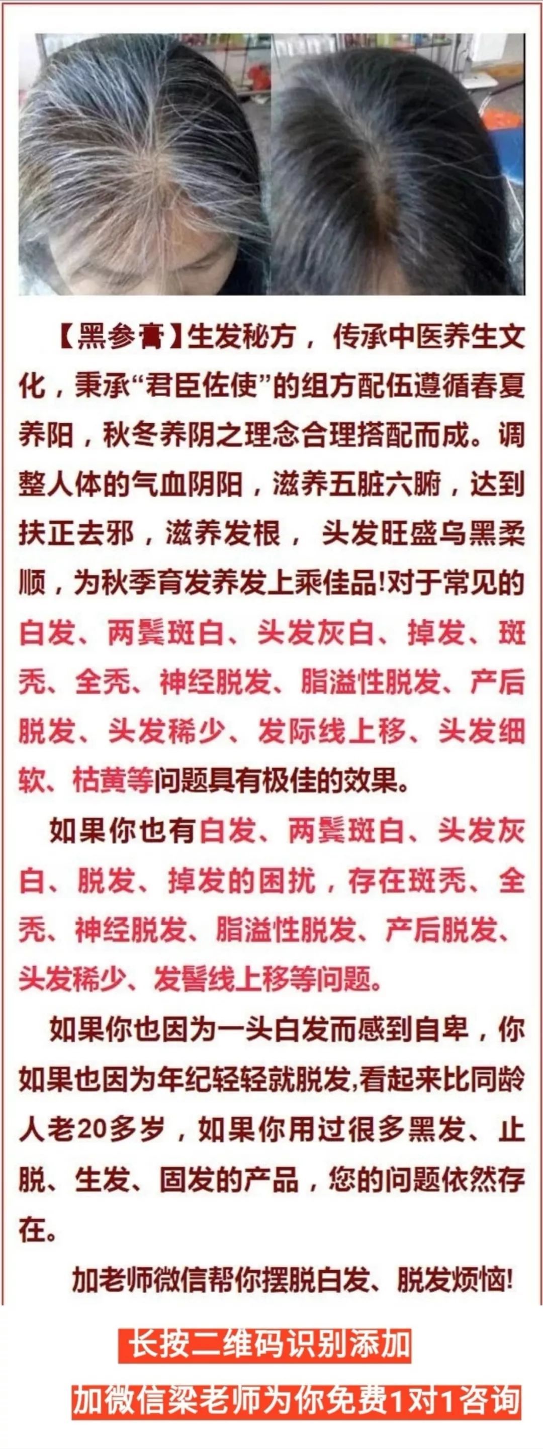 补硒元素能治疗白发吗