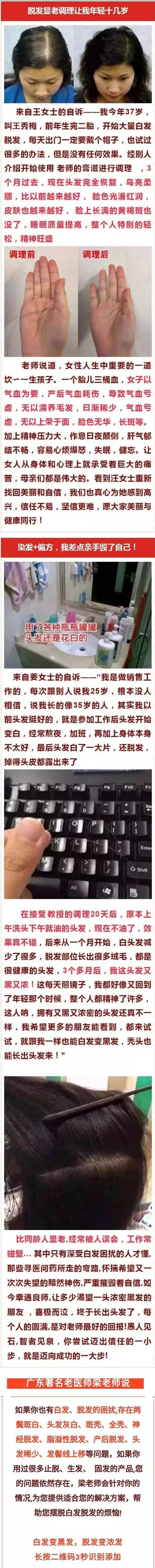 补硒元素能治疗白发吗