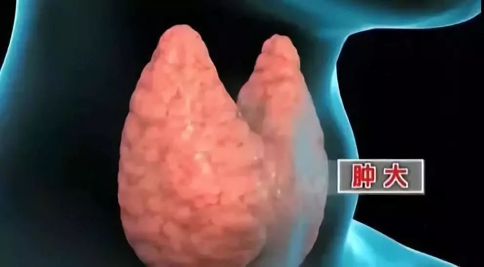 甲状腺结节补硒好不好(好补甲状腺结节硒片有用吗)-硒宝网