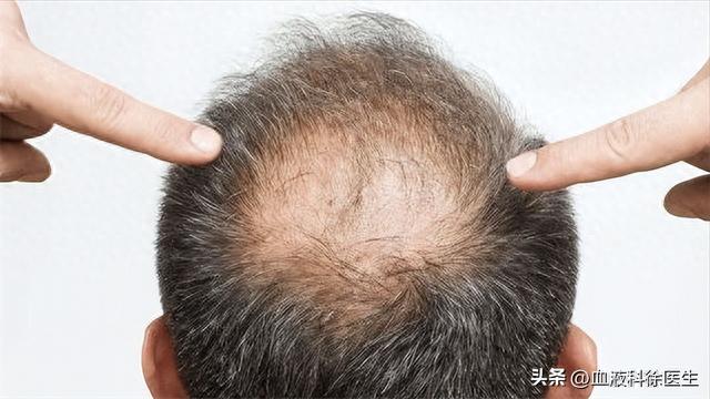 再次提醒：硒是抗癌、增强免疫力的必需元素，多吃3类食物就能补