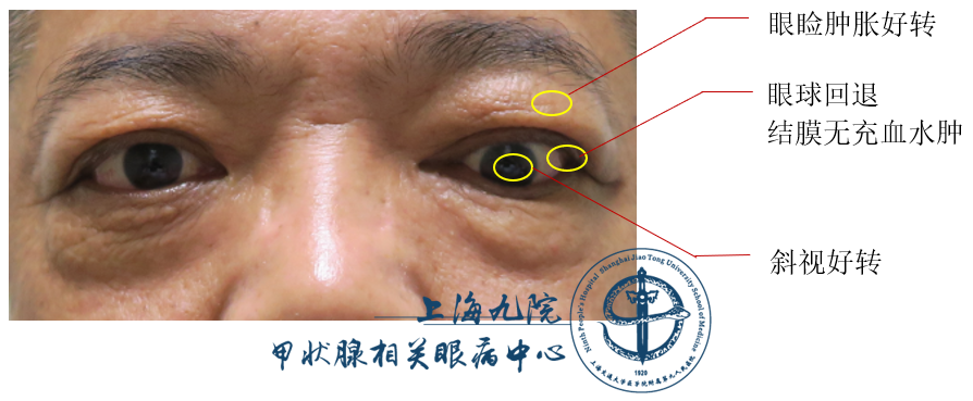 孕妇补硒方法