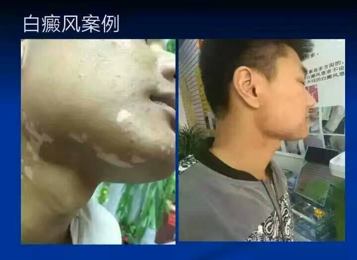 全球最好补硒