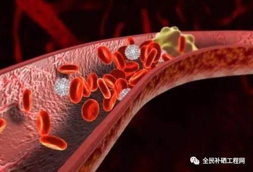 动脉硬化补硒(动脉硬化补硒)-硒宝网