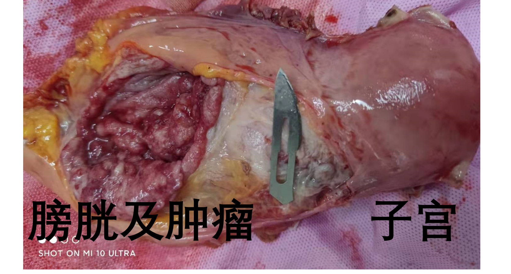 什么是硒补剂