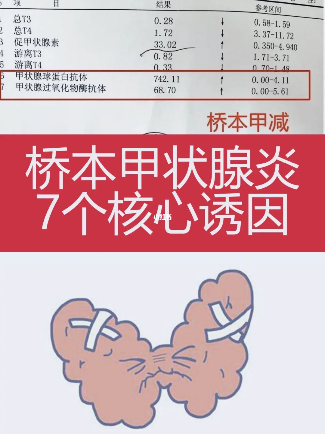 桥本病要补硒(补硒桥本)-硒宝网