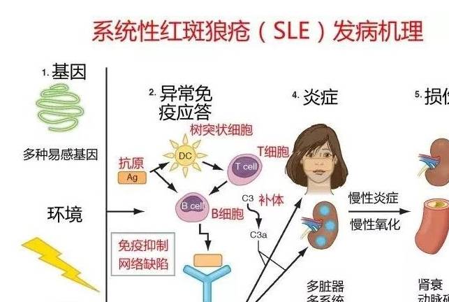 红斑狼疮补硒(系统性红斑狼疮可以补硒吗)-硒宝网
