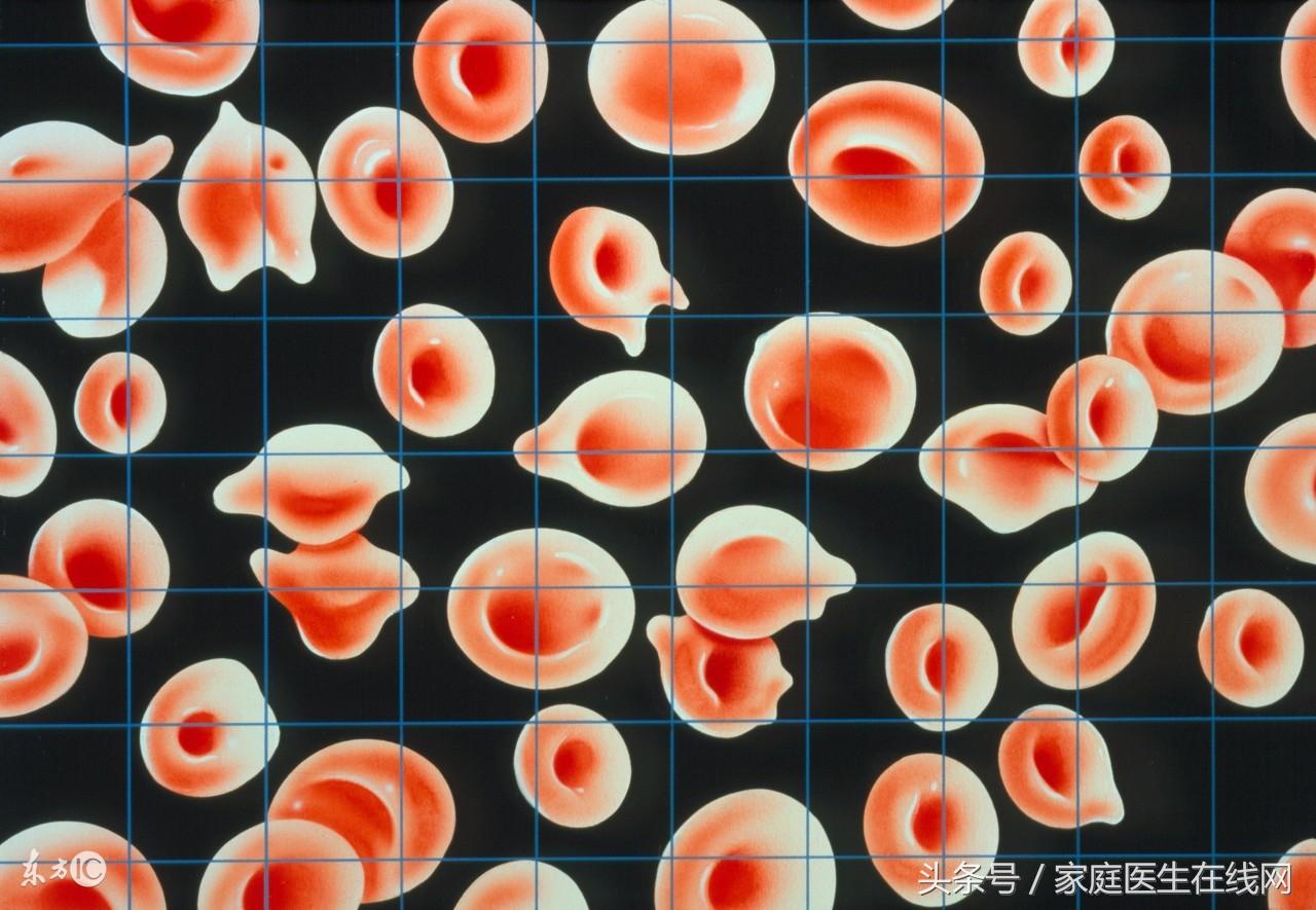 食补铁什么食物最佳