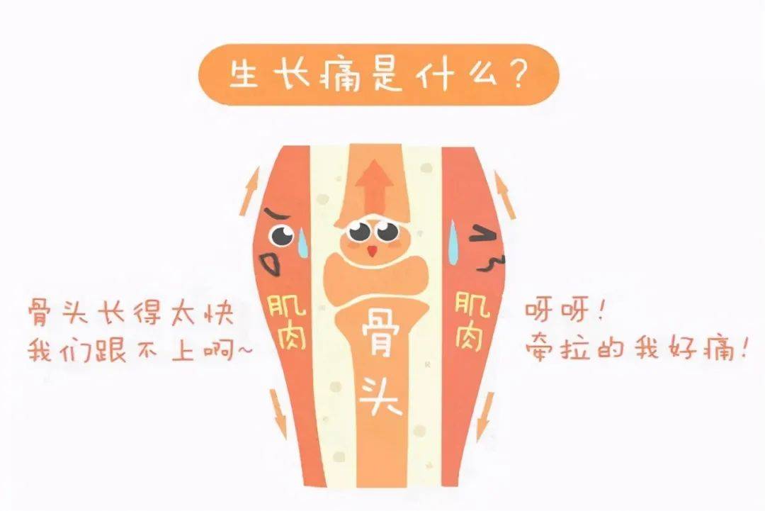 生长痛需要补钙吗