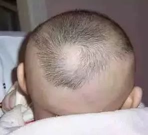 一岁多宝宝补钙哪种好