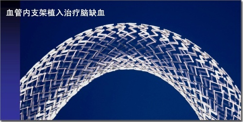 锌硒宝治疗?。ㄐ课τ行Ч穑?硒宝网