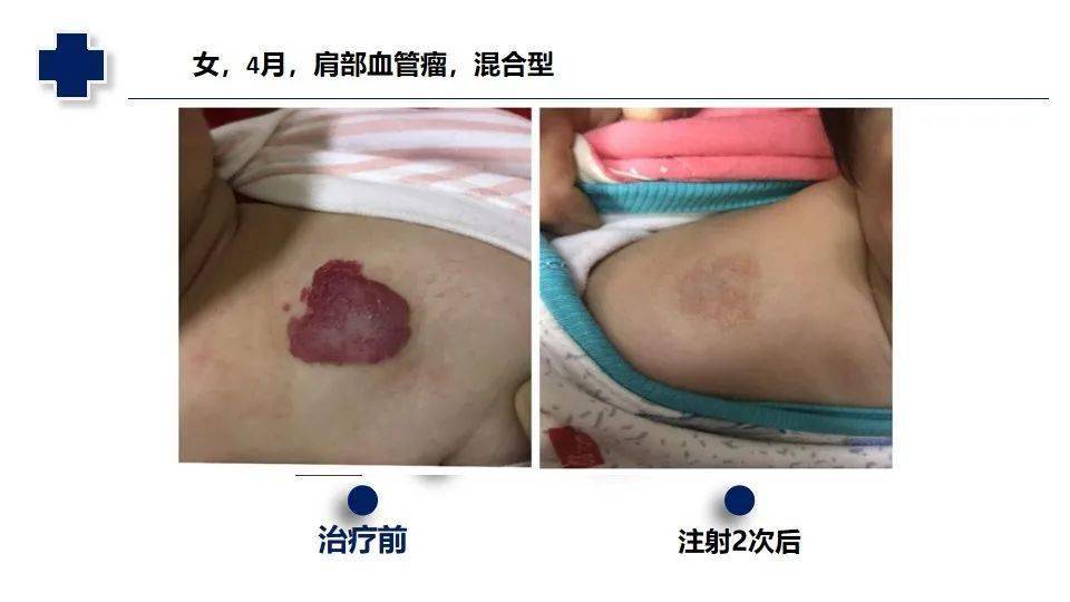 锌硒宝治疗病(锌硒宝有效果吗)-硒宝网