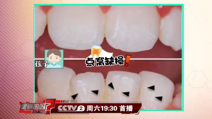 补钙能坚固牙齿吗