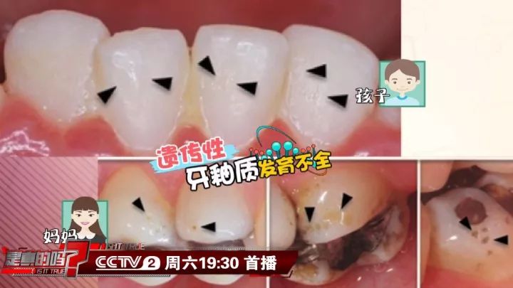 补钙能坚固牙齿吗