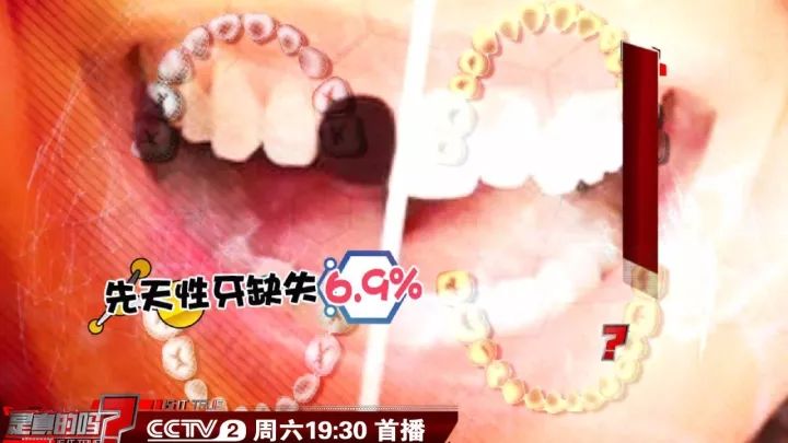 补钙能坚固牙齿吗