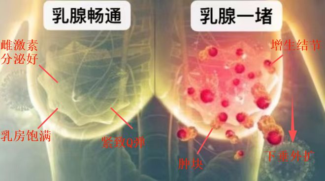 乳腺癌 硒维康