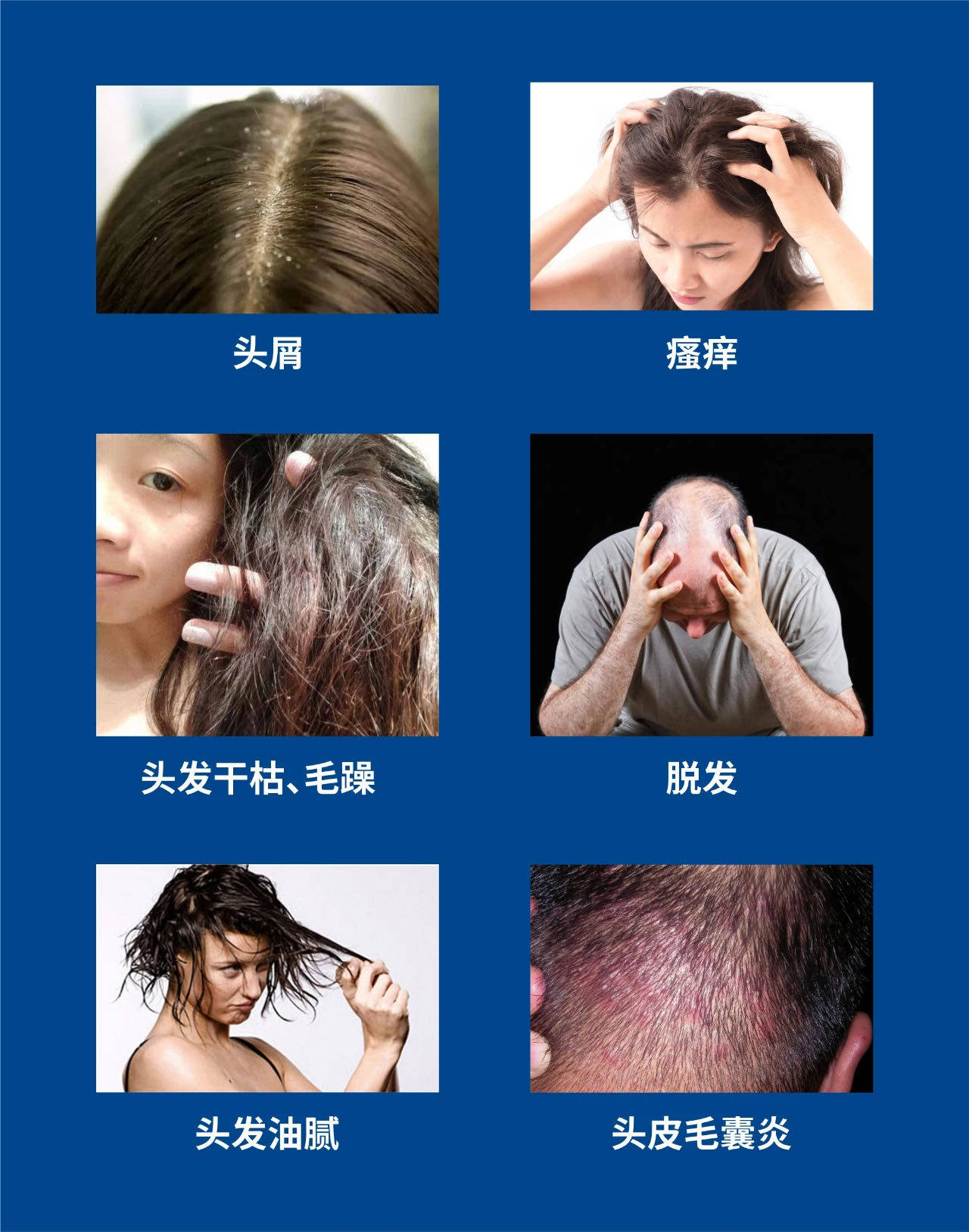 化验微量元素需要空腹吗