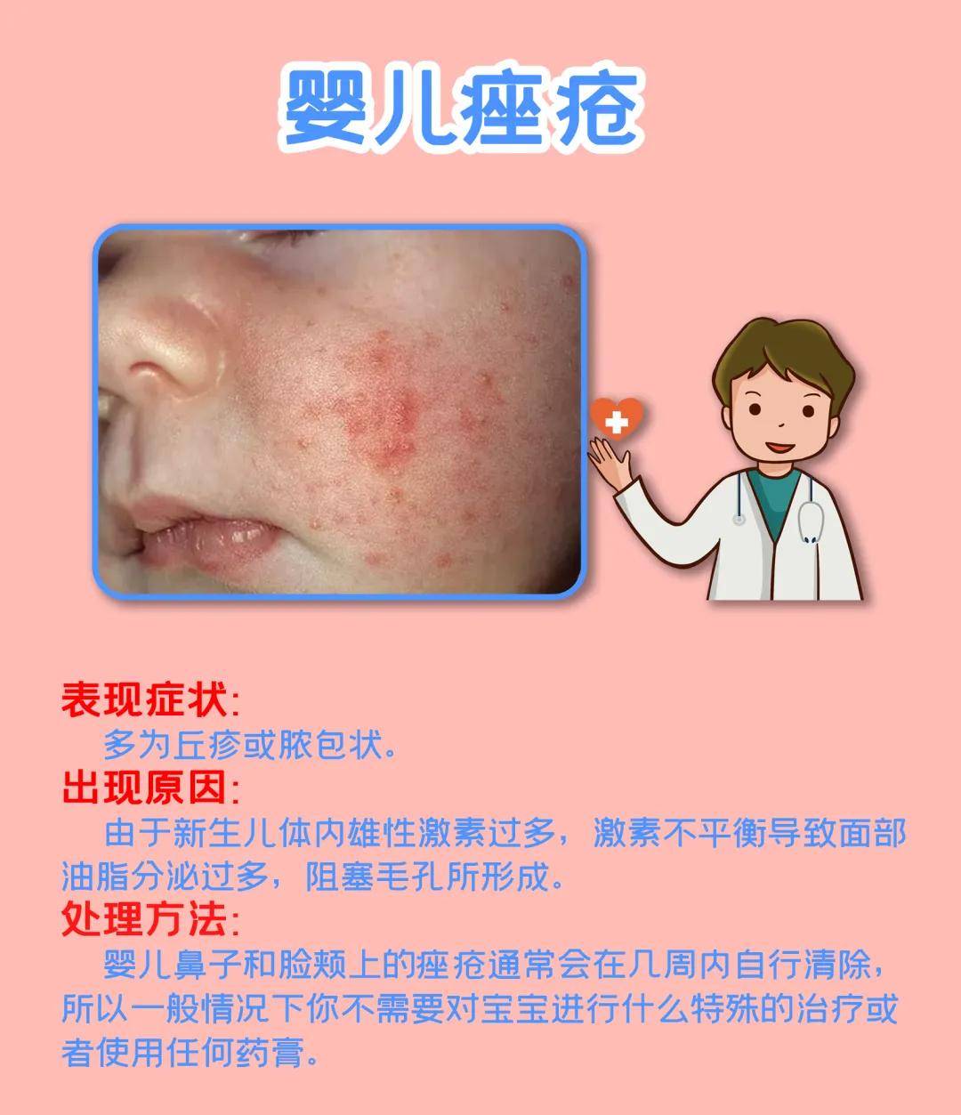补硒治皮脂囊肿