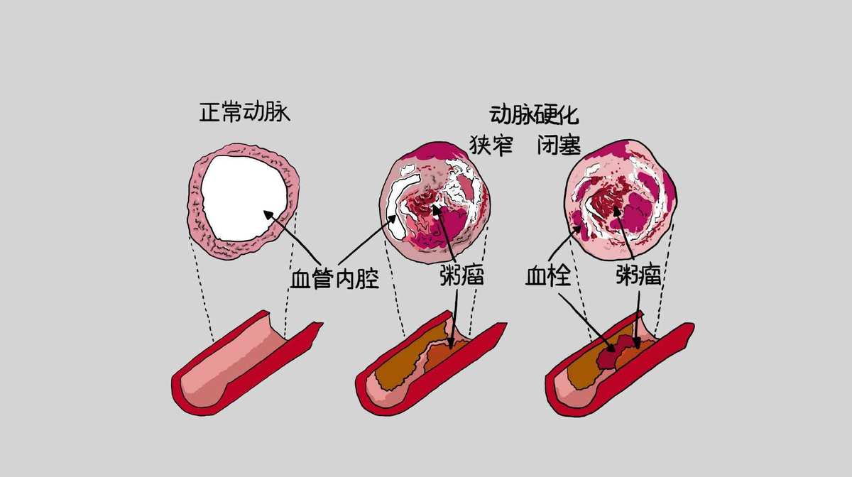 心脏病能补硒吗