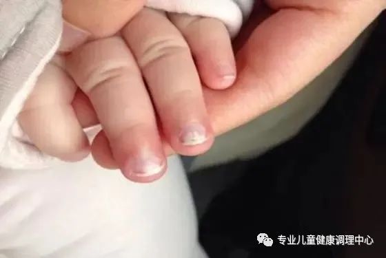 吃什么东西补锌