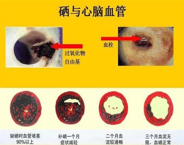 乙肝 补硒 量