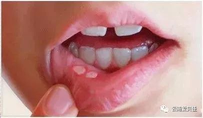 补锌补多了会怎么样