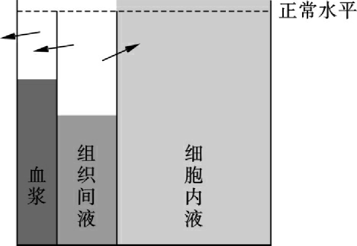 补钠计算公式