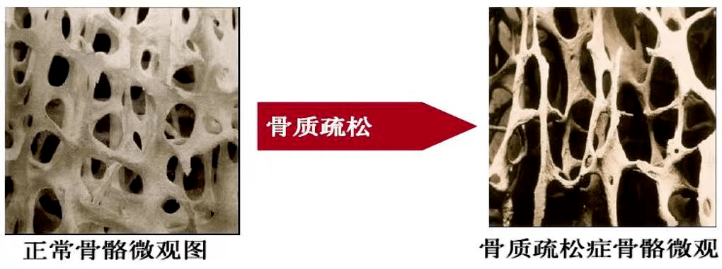 六十岁老人补钙哪一款好