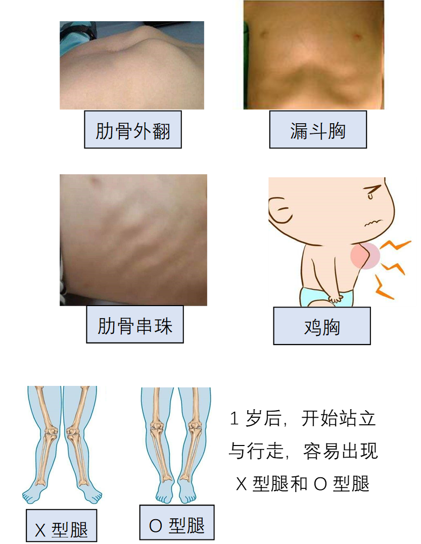 婴儿需要补锌吗
