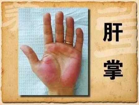 丙肝可以补硒吗
