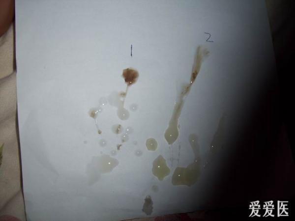 补硒会不会尿频