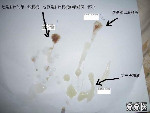 补硒会不会尿频