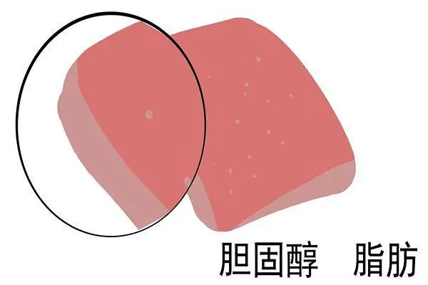 谷氨酰高 补硒