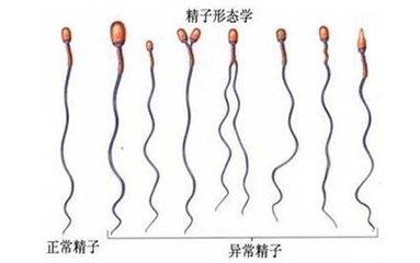 精子畸形率补硒