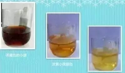 补硒后皮肤发黄