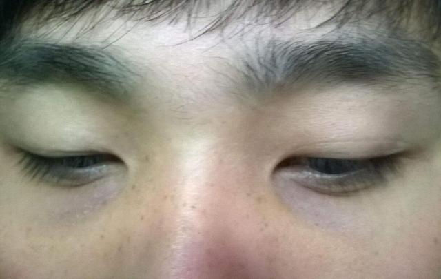 胃不好，脸上马上出现这3个症状，一招就让你调理好