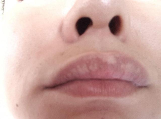胃不好，脸上马上出现这3个症状，一招就让你调理好