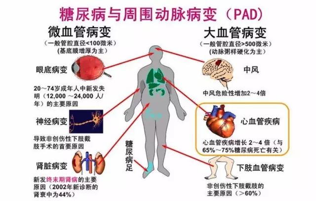 补硒预防糖尿?。ㄔし啦〔固悄蛭姆椒ǎ?硒宝网