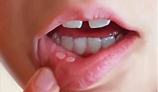 宝宝有这6种表现，说明缺锌了，妈妈别忽视，影响孩子发育就晚了