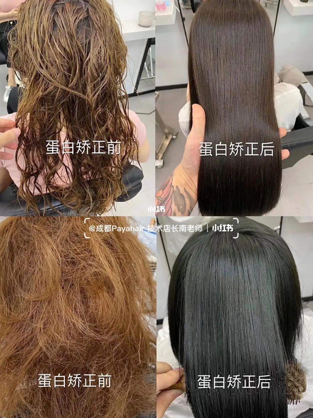 补硒后头皮屑多