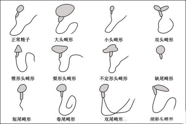 锌硒宝精子畸形