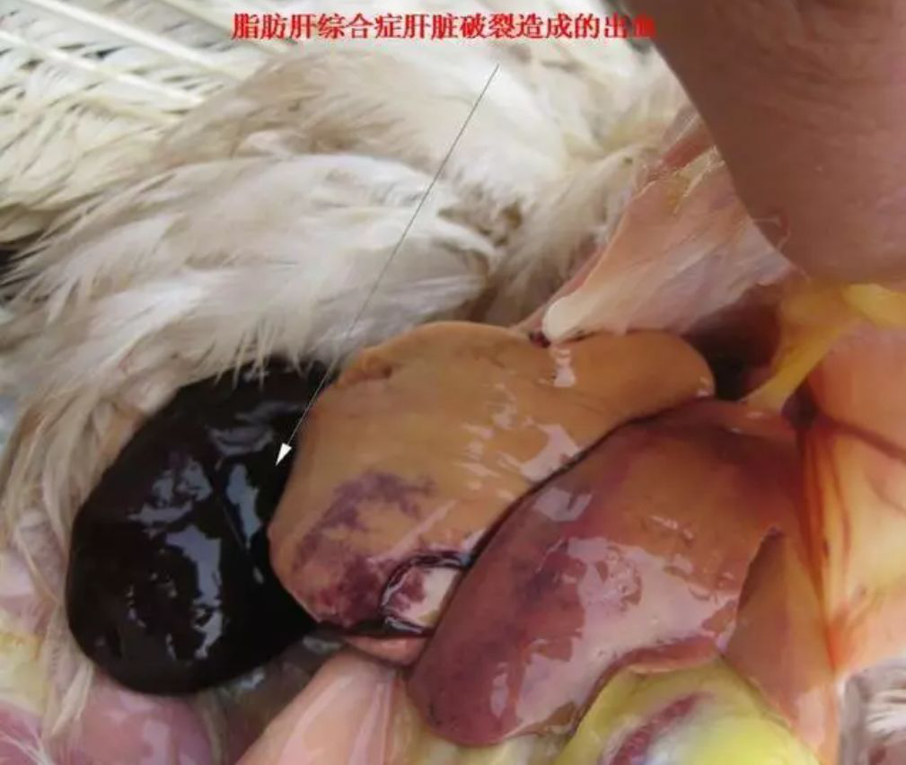 锌硒宝对肝好吗
